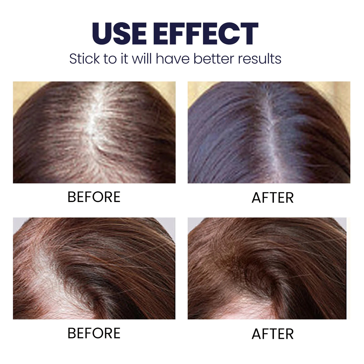 Ouhoe Hair Growth Spray Thinning Strengthen Roots Repair Dry Frizzy Collagen Formula No Residue 50ml Gentle for Sensitive Scalp Zpaxo