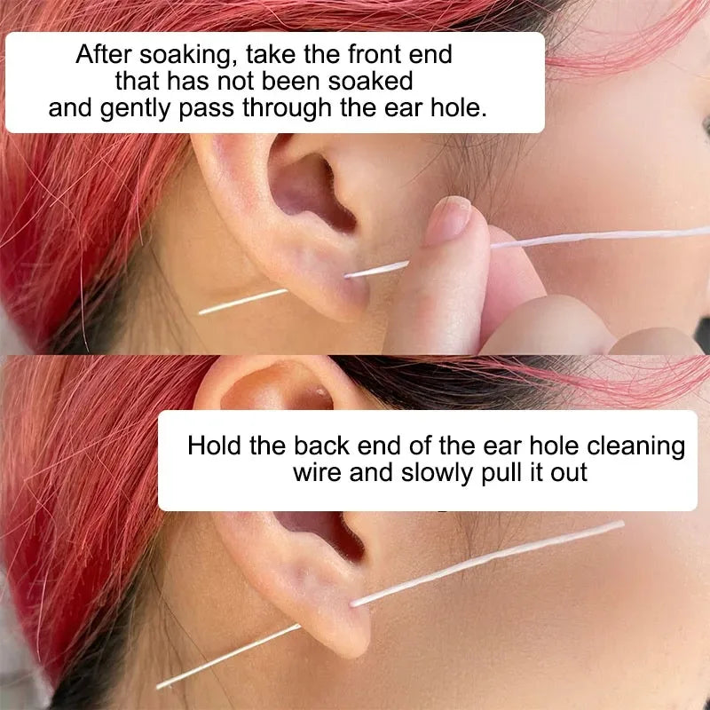 Ear Hole Cleaning Solution Safe Health Peach Flavor Inflamed Blockage Zpaxo