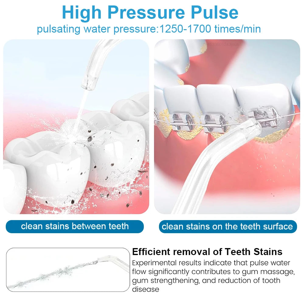 Water Flossser Oral Irrigator Pressure Dental Hygiene Flossing Teeth Zpaxo